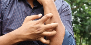 Pojavila se šuga u Dubrovniku, na oprezu škole i vrtići: Evo koji su simptomi