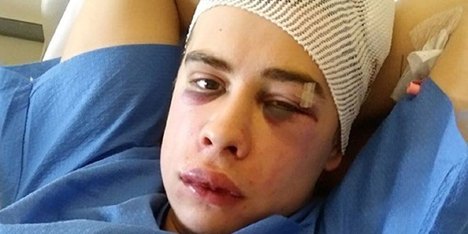 Majka moli za pomoć, prebili joj sina: 'Ovako izgleda dijete nakon koncerta'