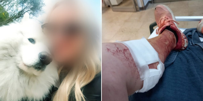 NAPAD U SRINJINAMA Ovčar koji je napao ženu i njenog samojeda proglašen opasnim 