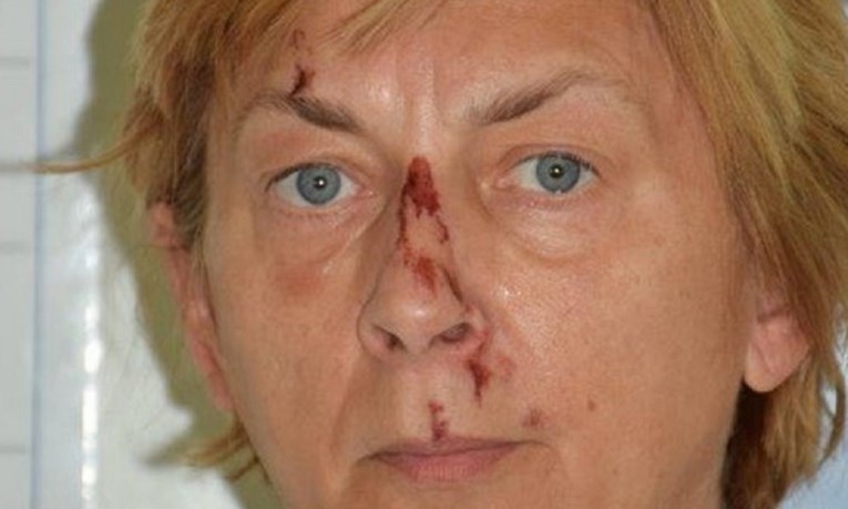 MISTERIJ ŽENE S KRKA: O slučaju pisao i CNN, nekoliko ljudi se javilo policiji