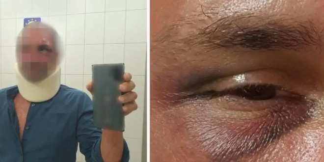 Beograđanina prebili na Korčuli 'Opsovao sam vozača kombija, mlatili su me gdje su stigli'