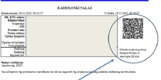 Bolnica kupila radiološki sustav, snimke preko računala