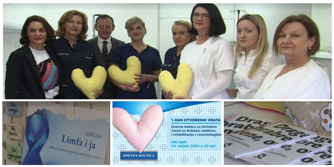 'Srce za Vas': Dan otvorenih vrata Dnevne bolnice za limfedem KBC-a Split 