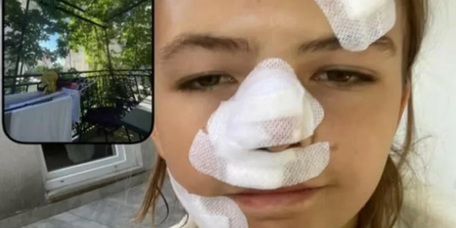Mlada Šveđanka svjedočila nesreći pred Centralom: Dobila sam 15 šavova na licu