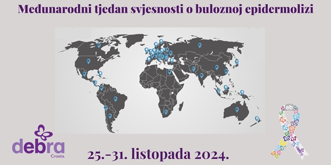 Počinje Međunarodni tjedan svjesnosti o rijetkoj genetskoj bolesti – buloznoj epidermolizi