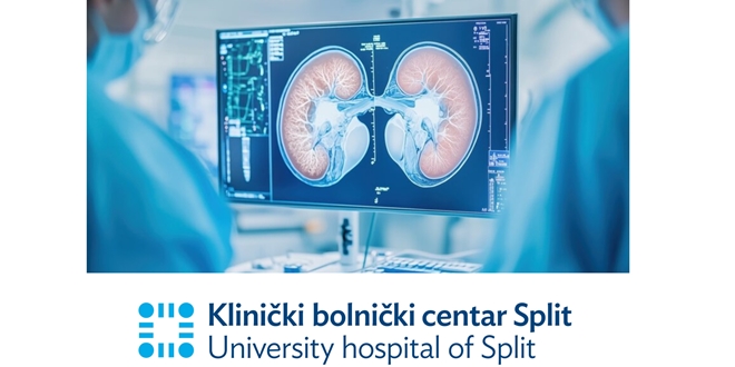 KBC Split dobio odobrenje za transplantaciju bubrega