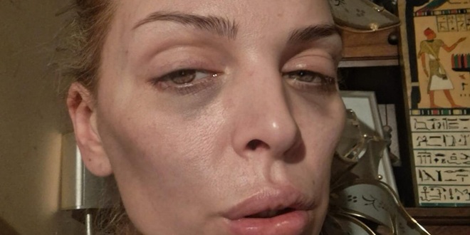 AVA JEZIVO IZGLEDA Objavila je fotografiju s vapajem za pomoć