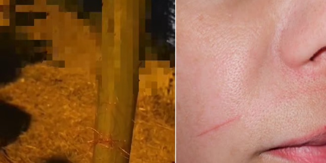 JEZIVO Motociklistkinju po licu zarezala 'krena' kojom je netko monstruozno prepriječio put