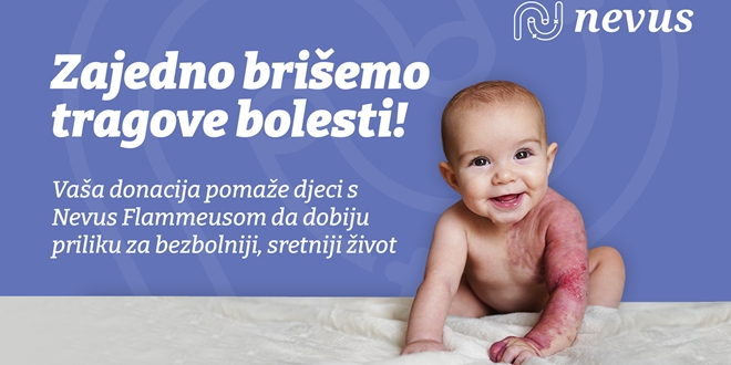 43.000 kilometara nade – i početak misije da nijedno dijete s dijagnozom Nevus Flammeus u Hrvatskoj više ne mora putovati na liječenje u inozemstvo