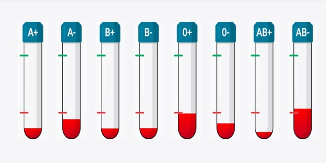 Hitan apel darivateljima: Smanjene zalihe krvi svih krvnih grupa